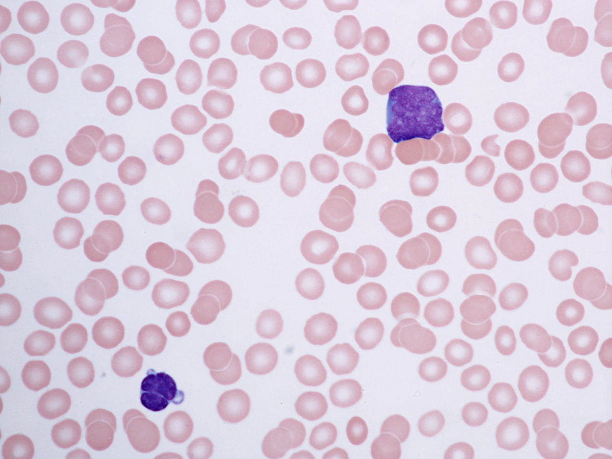 Blood